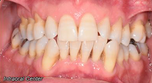 teeth treatment