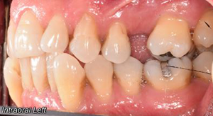 teeth treatment