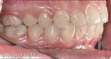 teeth treatment