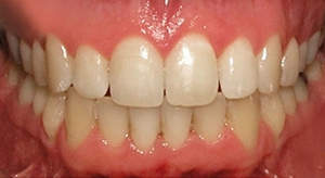 teeth treatment