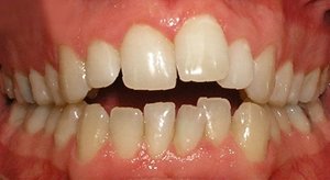 teeth treatment